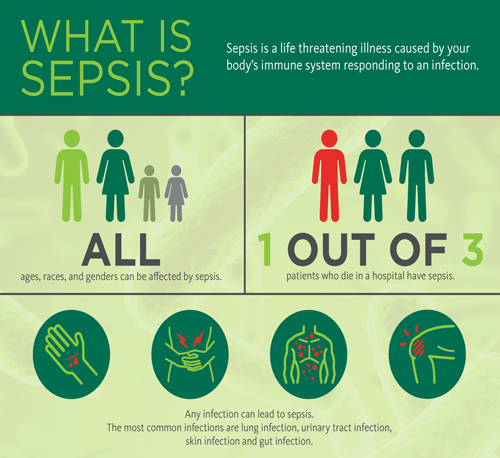 Sepsis Infographic